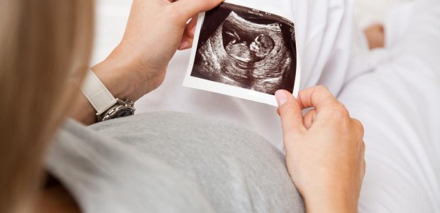 Prahos ligoninė per klaidą moteriai atliko abortą