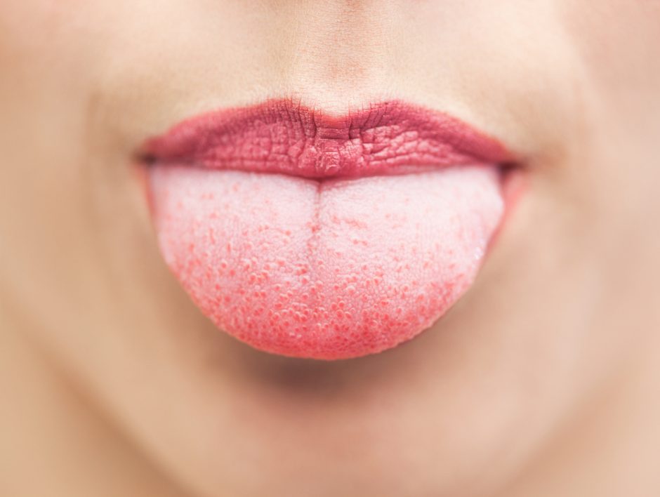 Jei patiriate daug streso, gali padidėti liežuvis