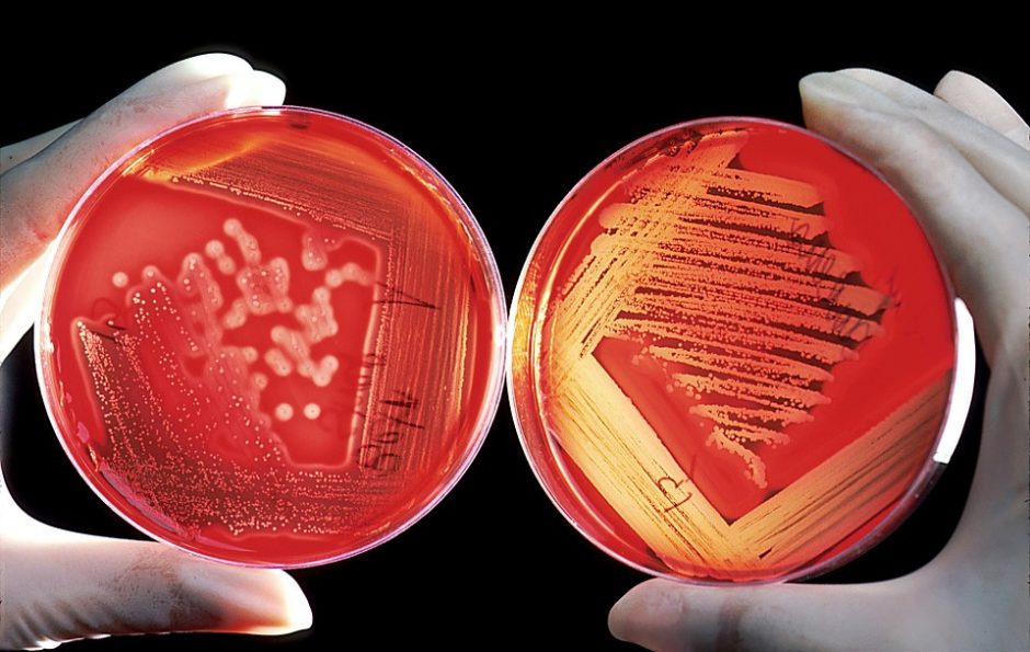 ES antibiotikams atsparios bakterijos kasmet pražudo 33 tūkst. žmonių