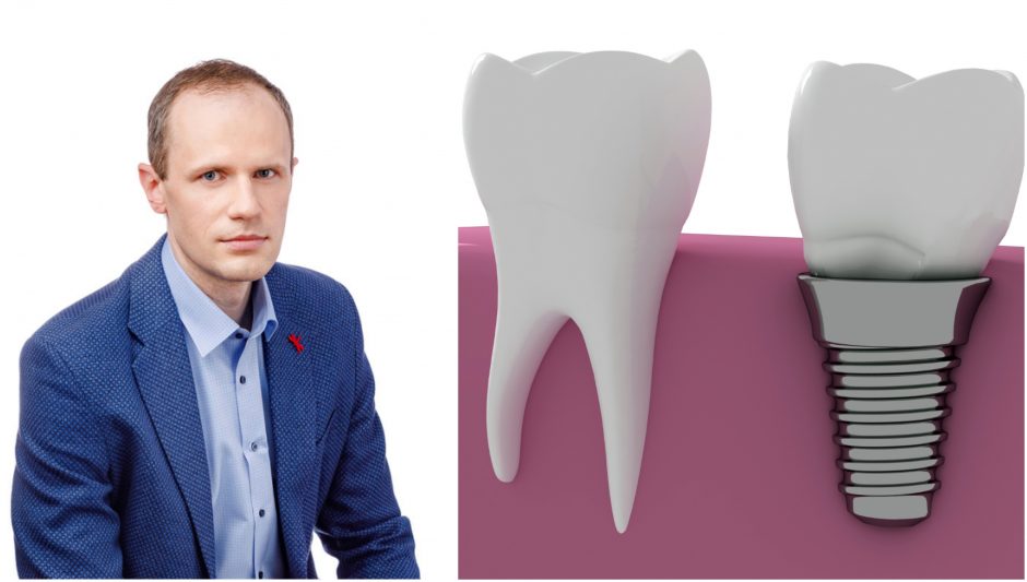 Dilema: saugoti esamus dantis ar sriegti implantus?