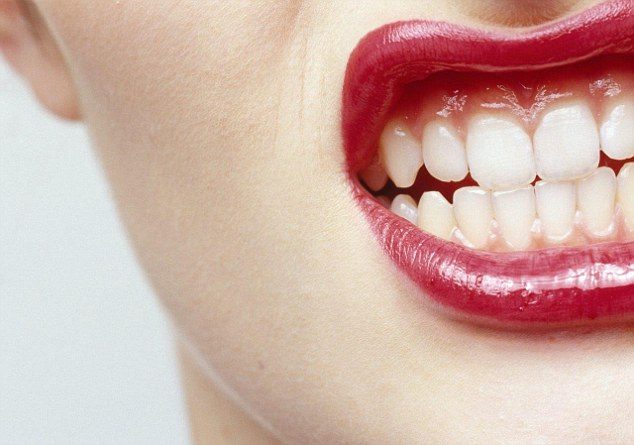 Dantų griežimas – naudingas sveikatai? 
