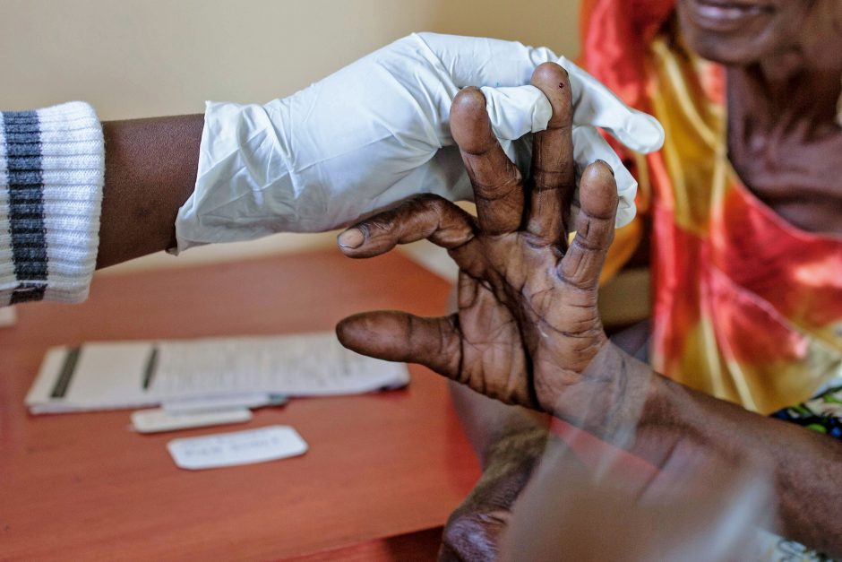 Afrikoje bus dideliu mastu išbandyti skiepai nuo maliarijos