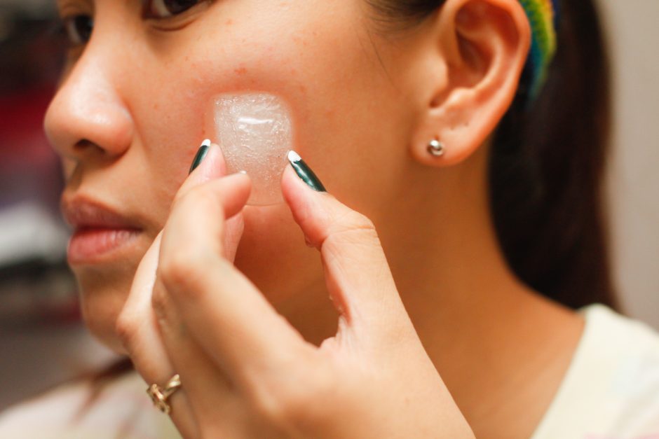 Specialistai: odos alergiją sukelia net natūraliausios medžiagos