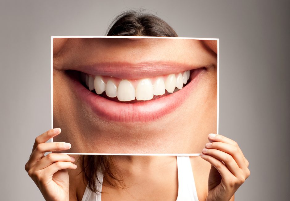 Odontologė: balti dantys – nebūtinai sveiki