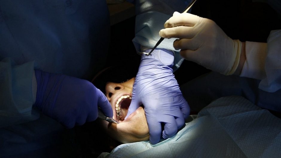 Gydytojas įspėja: praradus dantį, negalima delsti