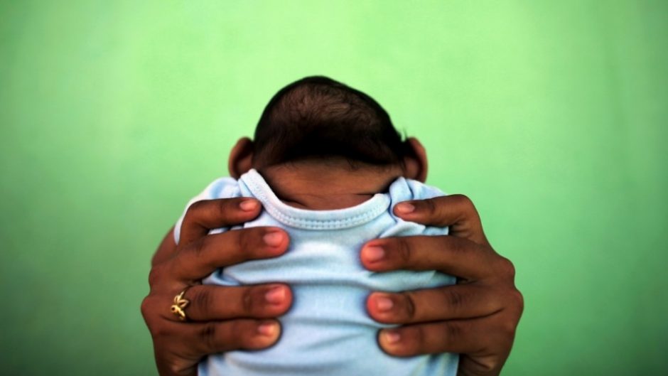 Floridoje gimė pirmas kūdikis su Zikos viruso defektu