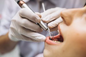 Eilėje pas ortodontą gali tekti laukti ir kelerius metus: trūksta specialistų