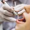 Odontologų paslaugų kainos dar augs