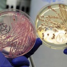Žmogaus nosyje gyvena unikali bakterija, gaminanti antibiotiką