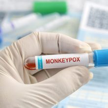 Lietuvą pasiekė vakcinos nuo beždžionių raupų