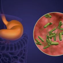 Vėžį galinčios sukelti skrandžio bakterijos gyvena daugelio skrandžiuose