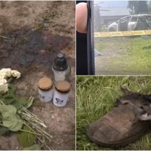 Prokuratūra: per sprogimą Molėtų rajone sužaloto jaunuolio būklė išlieka sunki