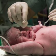 Pagalba: medikų teigimu, cezario pjūvio operacija negarantuoja laimingos gimdymo baigties.