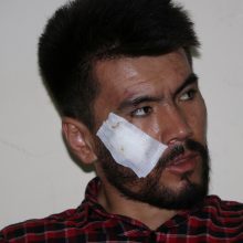 Atima žadą: paviešintos Talibano žiauriai sumuštų žurnalistų nuotraukos 