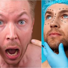 Kauno plastikos chirurgas, dailinęs recidyvisto nosį, tapo operacija nepatenkinto paciento įkaitu
