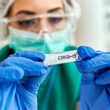 Per praėjusią parą šalyje – 419 koronaviruso atvejų, mirčių neužfiksuota