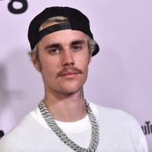 Dainininkui J. Bieberiui paralyžiavo pusę veido