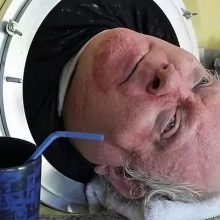 JAV mirė 78 metų sulaukęs „žmogus su geležiniais plaučiais“