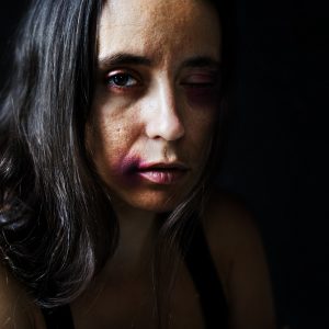 Prekybos žmonėmis auka: man rodė merginų nuotraukas – kai kurios buvo nužudytos