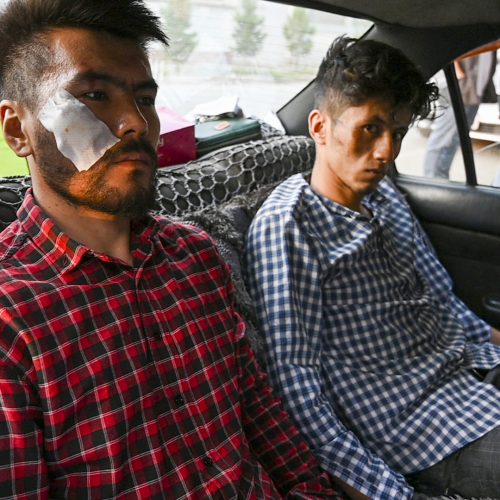 Paviešintos Talibano žiauriai sumuštų žurnalistų nuotraukos  © Scanpix nuotr.