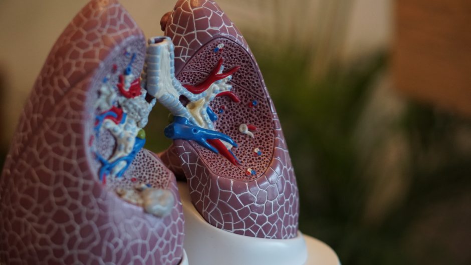 Biologinė terapija – raktas į gyvenimą be sunkios astmos