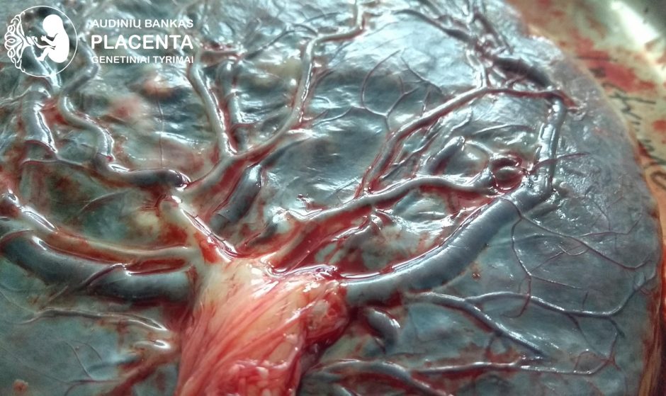 Virkštelės kraujo ląstelės – neįkainojami biologiniai vaistai