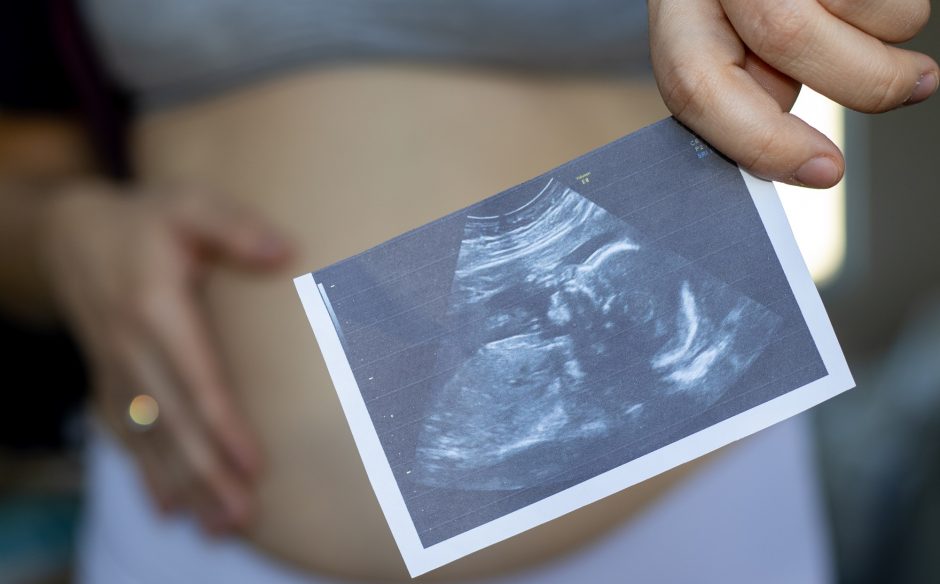 Pritarė siūlymui panaikinti prievolę amžinai saugoti embrionus