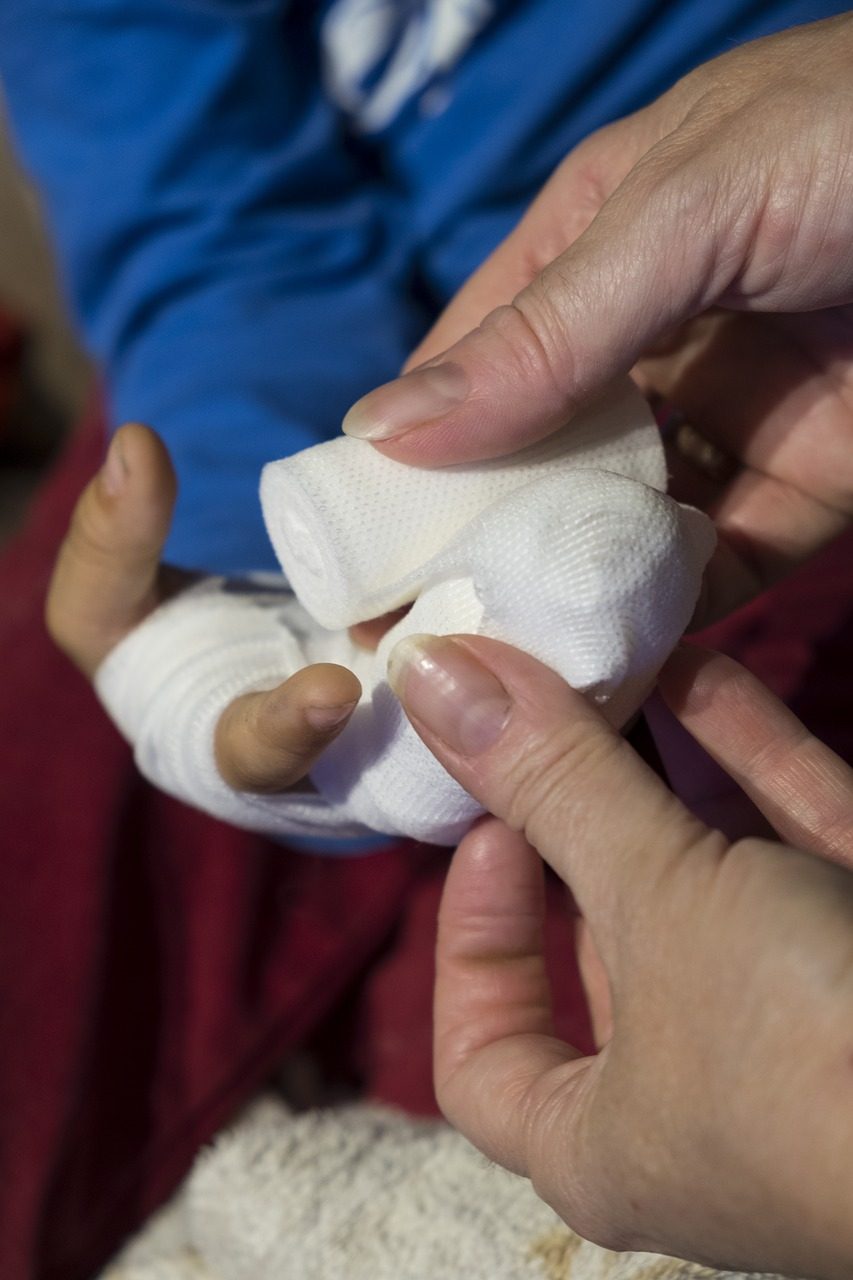 Po konflikto prie prekybos centro paauglys gydosi rankos lūžius