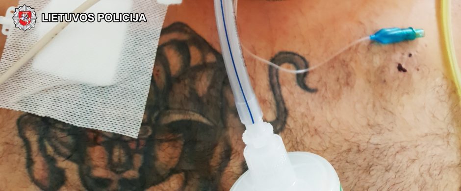 Prašo pagalbos: sumuštą vyrą padėtų atpažinti tatuiruotė