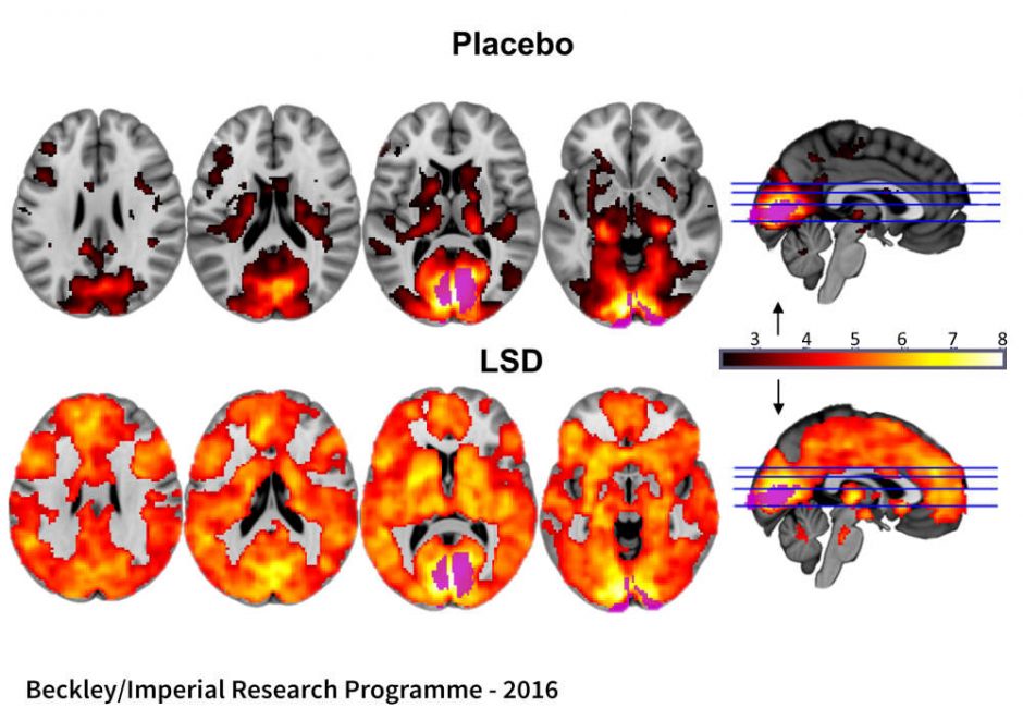 LSD reabilitacija: narkotikas taps efektyviu rytojaus vaistu?