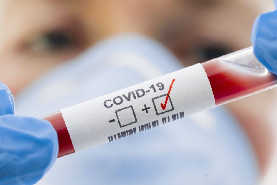 Latvijoje patvirtinti trys nauji užsikrėtimo COVID-19 atvejai