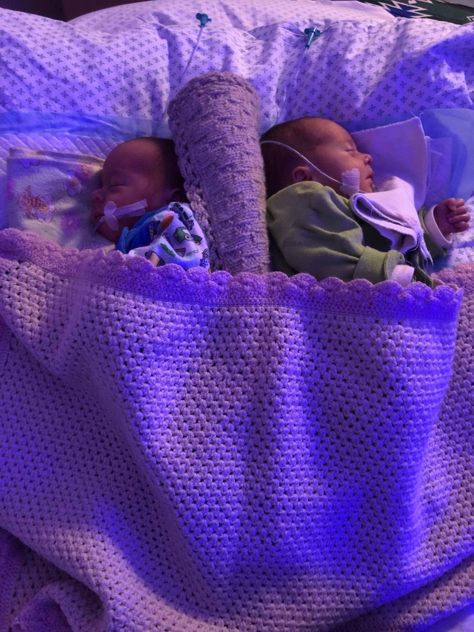 Lietuvos medikai pirmą kartą tokiu būdu išsaugojo dvynukų gyvybes