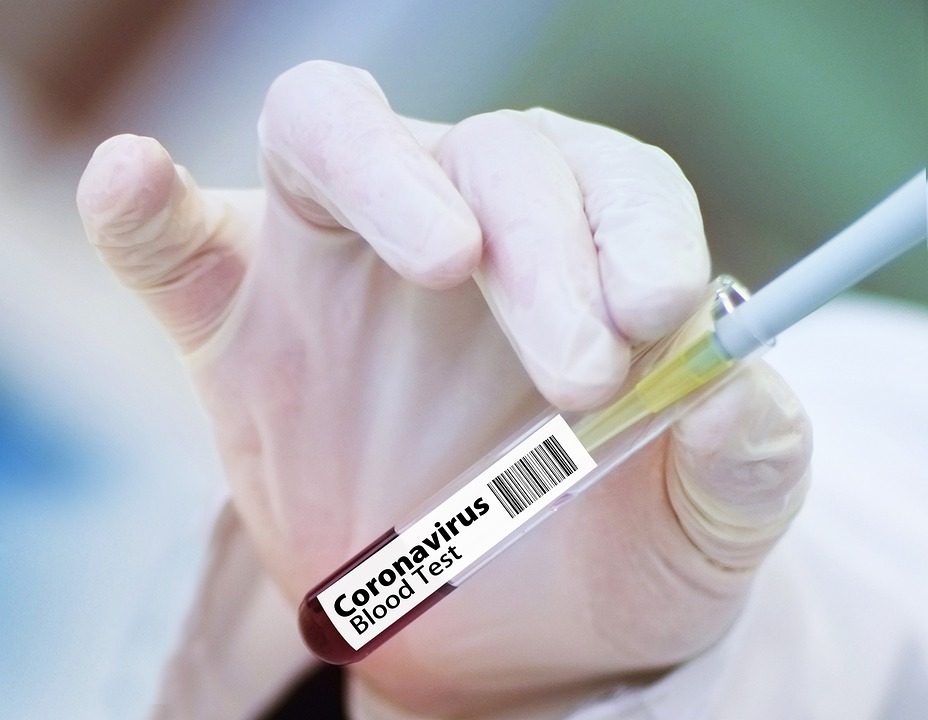 Koronavirusu užsikrėtė dar viena Vilniaus Šeškinės poliklinikos medikė