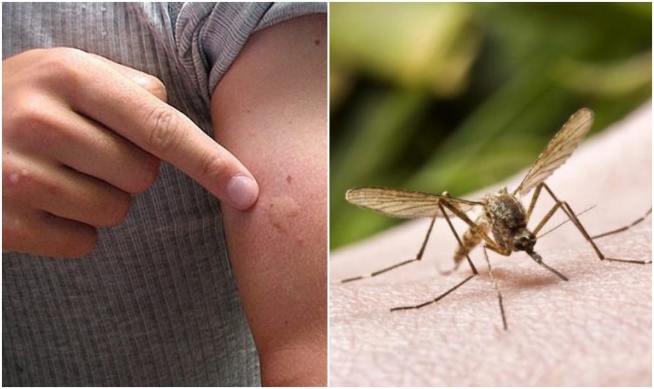 Kraujasiurbiai vabzdžiai ir apkartina poilsį, ir platina ligas: kaip apsisaugoti?