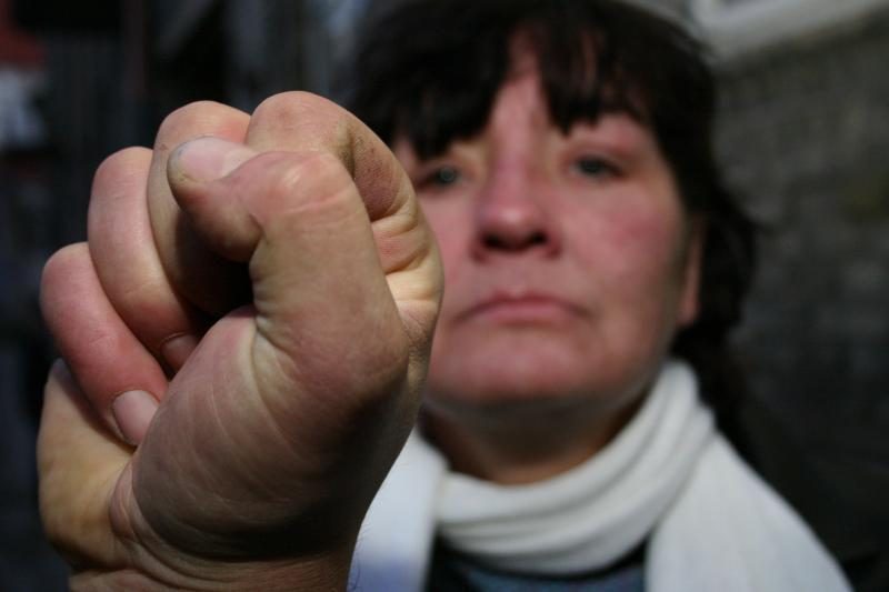 Rusijoje kasmet smurtą patiria 16 mln. moterų: sieks griežtesnių bausmių skriaudikams