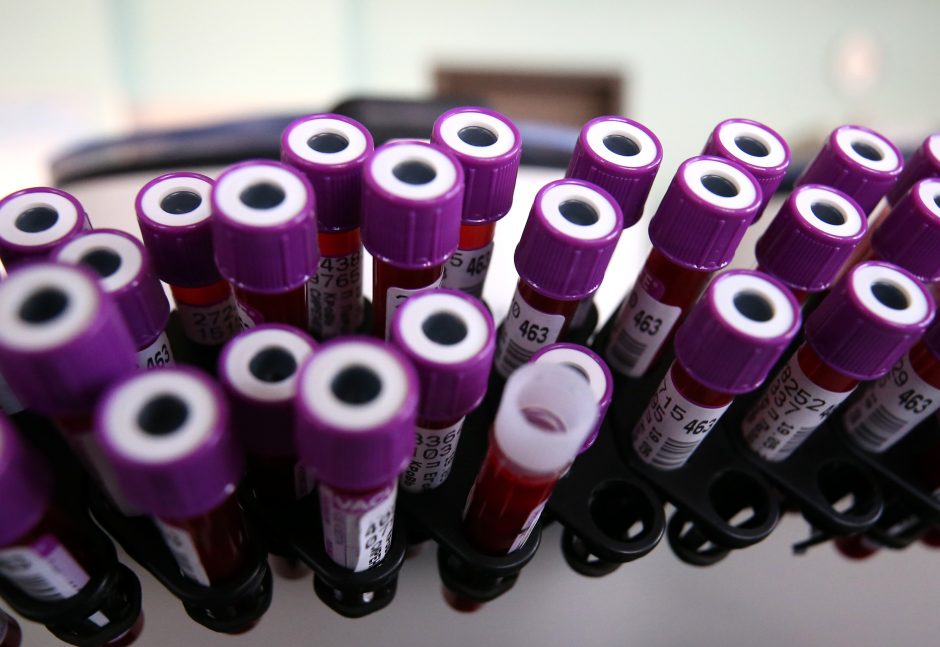 Koronavirusu užsikrėtus Nacionalinio vėžio instituto darbuotojai, tiriami 24 asmenys