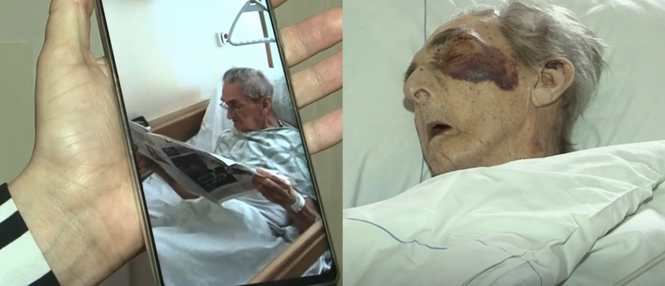 Šokiruojanti istorija: ligoninėje žiauriai sumuštas senolis