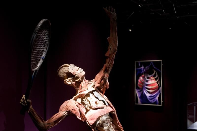 Prieštaringai vertinamoje parodoje – žmonių kūnai ir jų dalys