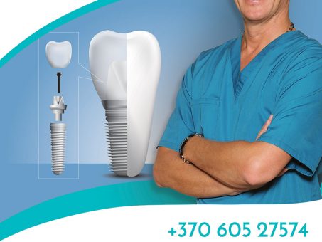 Skelbimas - Dantų implantai Marijampolėje - Ž. Kazakevičiaus implantologijos centras